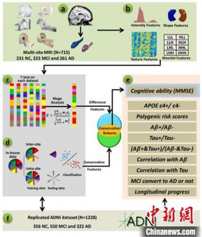 中国科研人员研究发现阿尔茨海默病早期识别标记